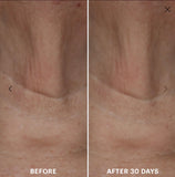 EGF Collection Bundle