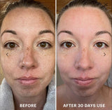 EGF Collection Bundle