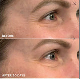 Glo Skin Beauty Bio-Renew EGF Eye Cream