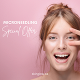 Microneedling Special Offer 3