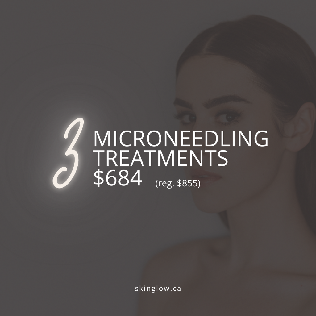 Package of 3 Microneedling Treatments